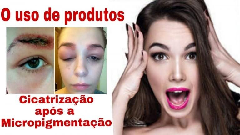 COMPLICAÇÕES DURANTE A CICATRIZAÇÃO APÓS MICROPIGMENTAÇÃO