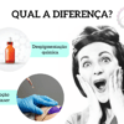 QUAL A DIFERENÇA DA REMOÇÃO COM LASER E DESPIGMENTAÇÃO QUÍMICA?