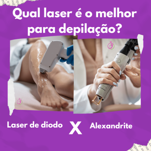 LASER ALEXANDRITE OU LASER DE DIODO: QUAL É O MELHOR?