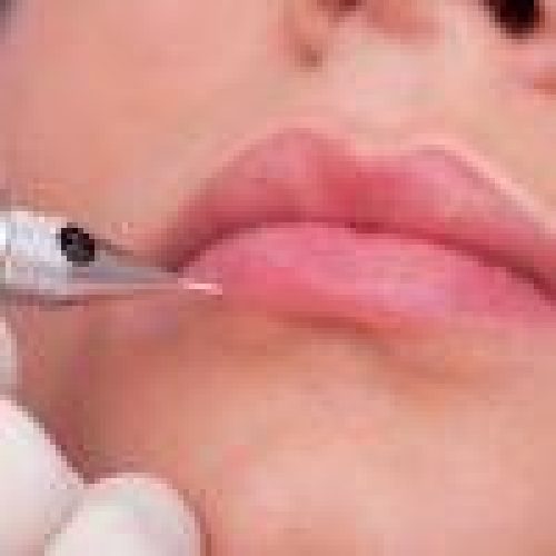 SAIBA TUDO SOBRE MICROPIGMENTAÇÃO LABIAL